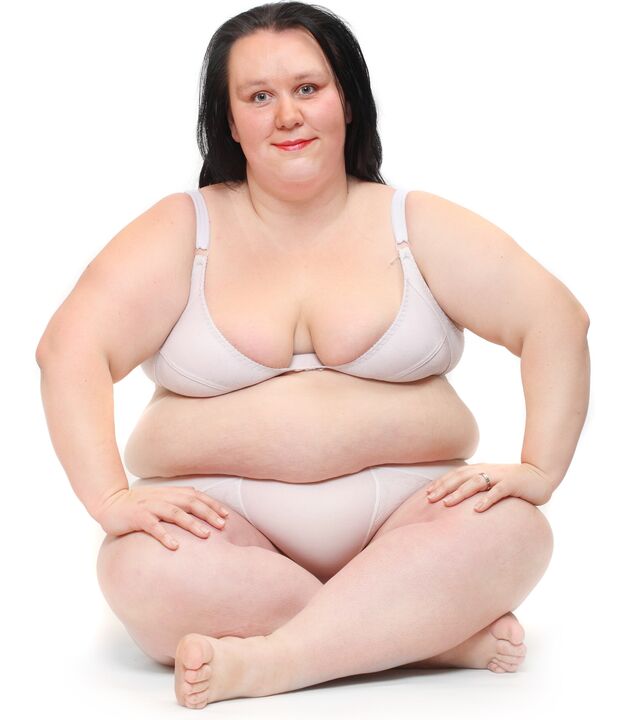 Žena s viškom kilograma